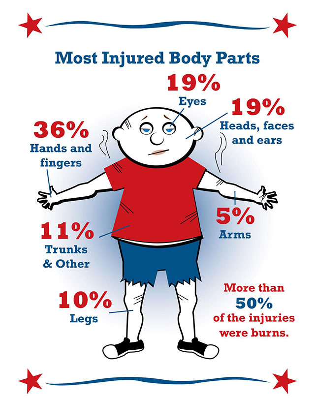 Fireworks Injuries to the Body